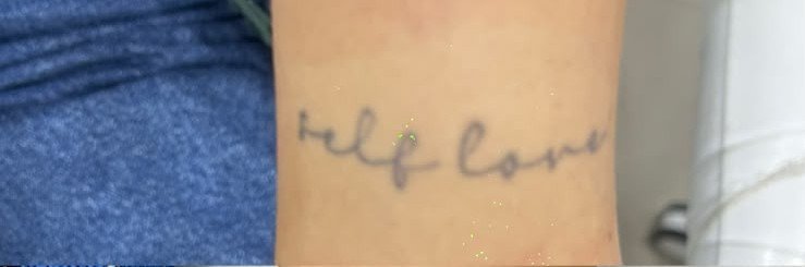 Before tattoo fading
