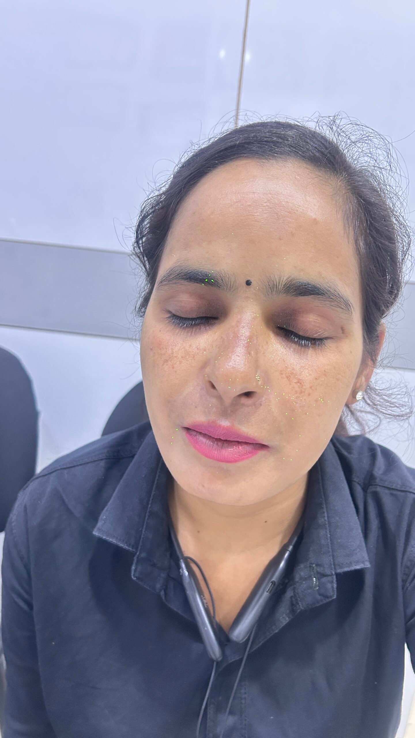 After skin improvement