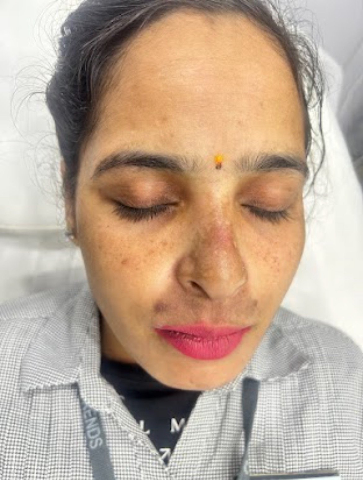 Before skin condition