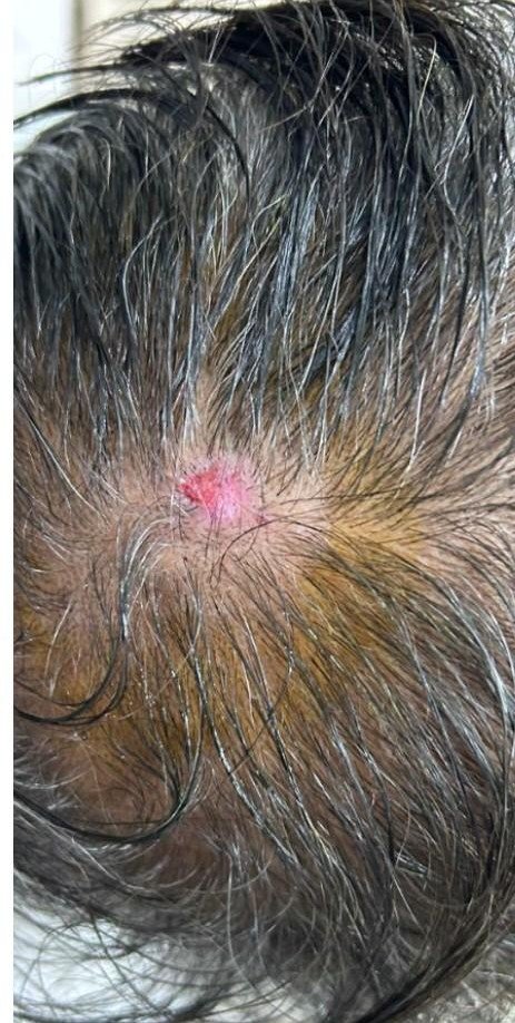 After scalp condition