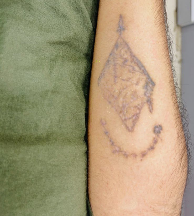After tattoo appearance